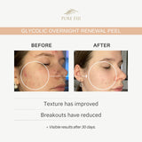 Glycolic Overnight Renewal Peel with Mandelic + Niacinamide (1oz/30ml)